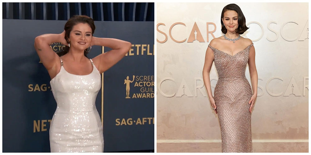 Селена Гомес до и после похудения/ Фото: соцсети певицы и ролики YouTube